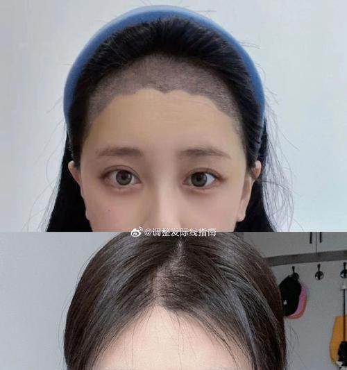 手机额头拍照设置方法是什么？