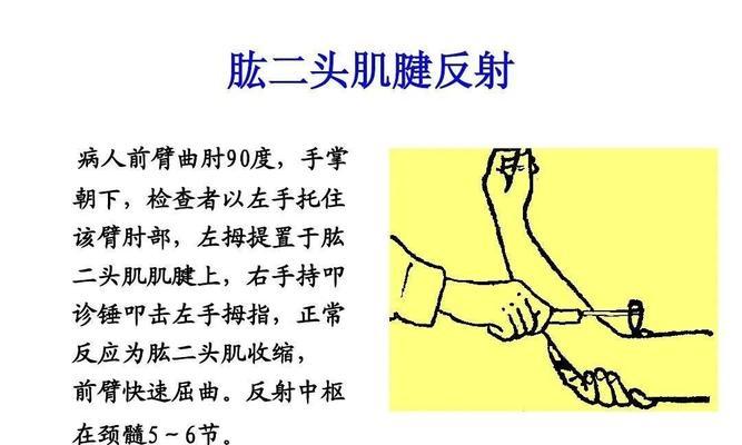 偏斜反射技能制作方法是什么？