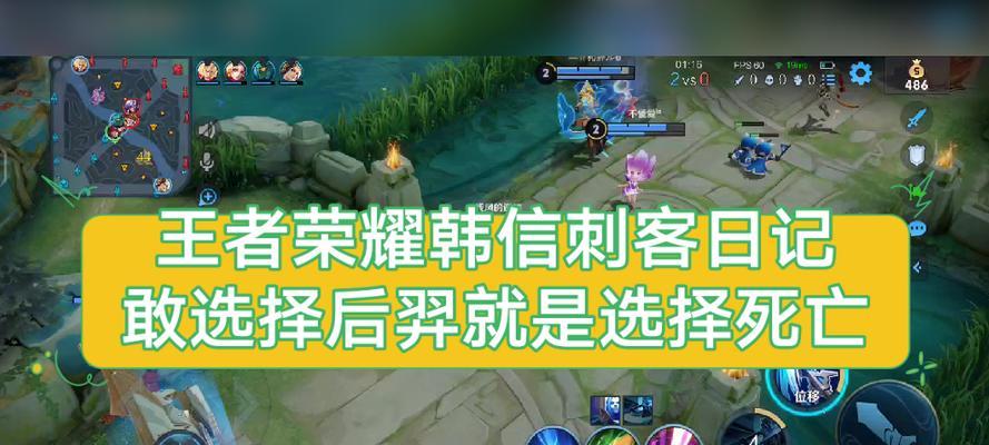 王者荣耀挂件选择指南及常见问题？