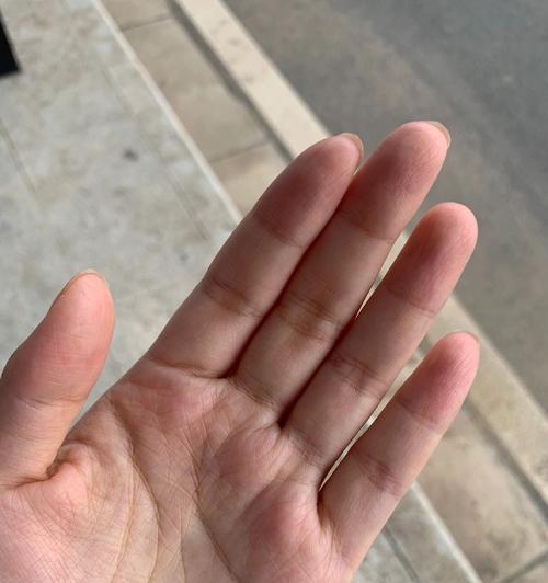 手机壳指纹松了怎么修理？修理步骤和注意事项有哪些？