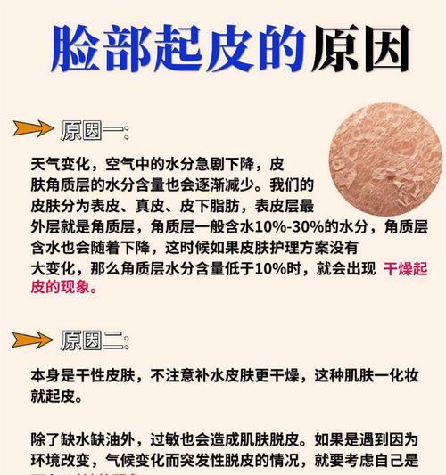 换季时脸上脱皮怎么办（针对不同肤质的换季护肤方法和常见误区）